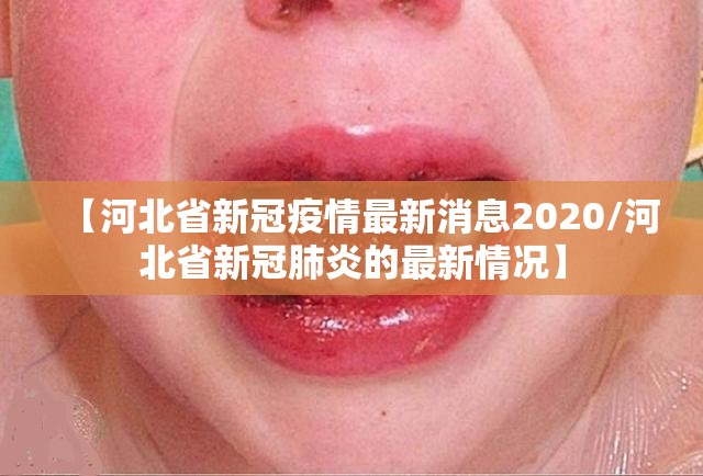 【河北省新冠疫情最新消息2020/河北省新冠肺炎的最新情况】