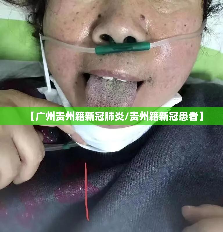 【广州贵州籍新冠肺炎/贵州籍新冠患者】