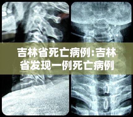 吉林省死亡病例:吉林省发现一例死亡病例