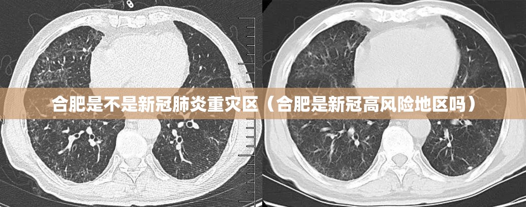 合肥是不是新冠肺炎重灾区（合肥是新冠高风险地区吗）
