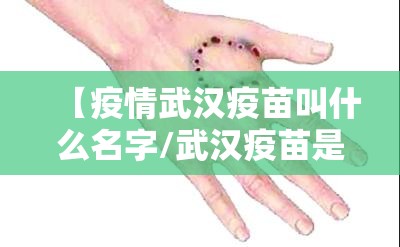 【疫情武汉疫苗叫什么名字/武汉疫苗是什么疫苗】