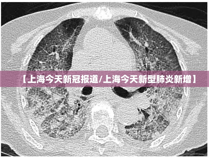 【上海今天新冠报道/上海今天新型肺炎新增】